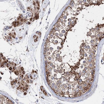 Anti-NGLY1 antibody produced in rabbit Prestige Antibodies&#174; Powered by Atlas Antibodies, affinity isolated antibody, buffered aqueous glycerol solution