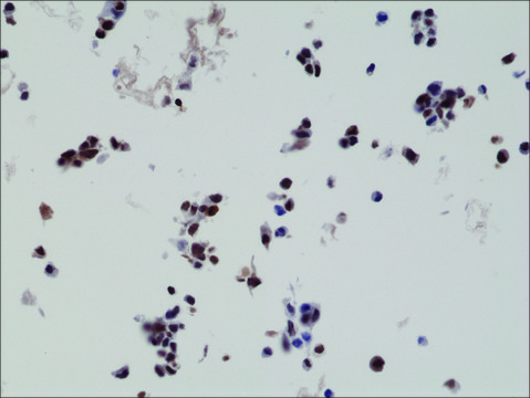 Anti-HA-Tag antibody, Rabbit Monoclonal recombinant, expressed in HEK 293 cells, clone RM305, purified immunoglobulin