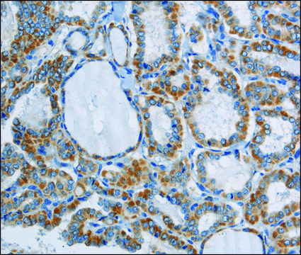 Anti-PPARGC1B antibody produced in rabbit affinity isolated antibody