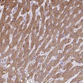 Anti-CYB5A antibody produced in rabbit Prestige Antibodies&#174; Powered by Atlas Antibodies, affinity isolated antibody, buffered aqueous glycerol solution