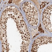 Anti-GPATCH11 antibody produced in rabbit Prestige Antibodies&#174; Powered by Atlas Antibodies, affinity isolated antibody, buffered aqueous glycerol solution