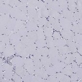 Anti-ALDH7A1 antibody produced in rabbit Prestige Antibodies&#174; Powered by Atlas Antibodies, affinity isolated antibody, buffered aqueous glycerol solution