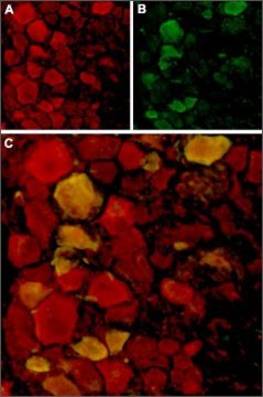 Anti-TRPV4 antibody produced in rabbit affinity isolated antibody, lyophilized powder