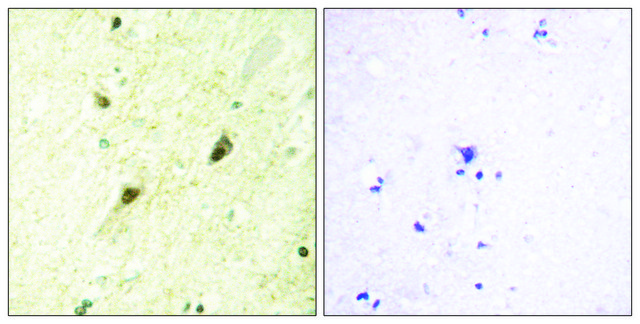 Anti-GLI-3 antibody produced in rabbit affinity isolated antibody