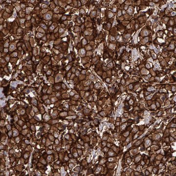 Anti-ERBB2 antibody produced in rabbit Ab1, Prestige Antibodies&#174; Powered by Atlas Antibodies, affinity isolated antibody, buffered aqueous glycerol solution