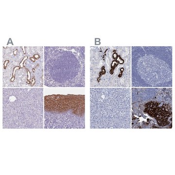 Anti-RHCG antibody produced in rabbit Prestige Antibodies&#174; Powered by Atlas Antibodies, affinity isolated antibody, buffered aqueous glycerol solution