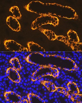 Anti-PDZK1 Antibody, clone 5C1D3, Rabbit Monoclonal