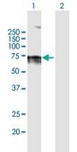 Anti-LBR antibody produced in mouse IgG fraction of antiserum, buffered aqueous solution