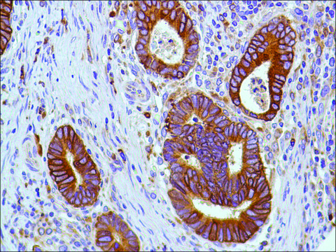 Anti-COX2 antibody, Rabbit monoclonal clone SP21, recombinant, expressed in proprietary host, tissue culture supernatant