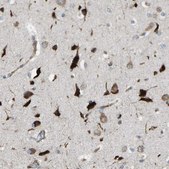 Anti-VPS41 antibody produced in rabbit Prestige Antibodies&#174; Powered by Atlas Antibodies, affinity isolated antibody, buffered aqueous glycerol solution, Ab2
