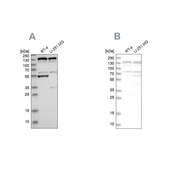 Anti-GOLGA2 antibody produced in rabbit Prestige Antibodies&#174; Powered by Atlas Antibodies, affinity isolated antibody, buffered aqueous glycerol solution, Ab1