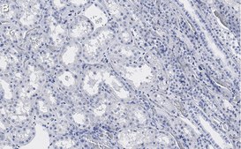 Anti-PP2A C subunit Antibody, clone 2B15 ZooMAb&#174; Rabbit Monoclonal recombinant, expressed in HEK 293 cells