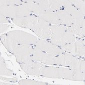 Anti-VSX2 antibody produced in rabbit Prestige Antibodies&#174; Powered by Atlas Antibodies, affinity isolated antibody, buffered aqueous glycerol solution