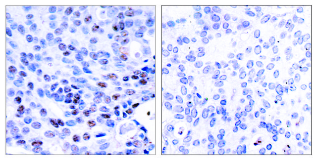 Anti-NF-&#954;B p105 antibody produced in rabbit affinity isolated antibody