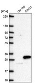 Anti-GINS1 antibody produced in rabbit Prestige Antibodies&#174; Powered by Atlas Antibodies, affinity isolated antibody, buffered aqueous glycerol solution