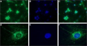 Anti-Calcium Channel CaV3.2 (&#945;1H) antibody produced in rabbit affinity isolated antibody, lyophilized powder