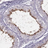 Anti-RSPH6A antibody produced in rabbit Prestige Antibodies&#174; Powered by Atlas Antibodies, affinity isolated antibody, buffered aqueous glycerol solution