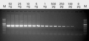 Transcriptase inverse Transcriptor