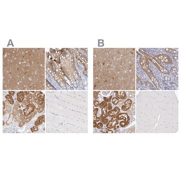 Anti-GDA antibody produced in rabbit Prestige Antibodies&#174; Powered by Atlas Antibodies, affinity isolated antibody, buffered aqueous glycerol solution