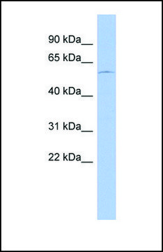 Anti-DMRT2, (N-terminal) antibody produced in rabbit affinity isolated antibody