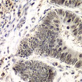 Anti-SMARCA4 antibody produced in rabbit