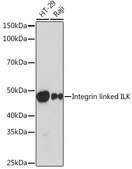 Anti-Integrin linked ILK Antibody, clone 5R10U3, Rabbit Monoclonal