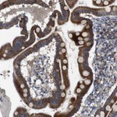 Anti-CHST10 antibody produced in rabbit Prestige Antibodies&#174; Powered by Atlas Antibodies, affinity isolated antibody, buffered aqueous glycerol solution