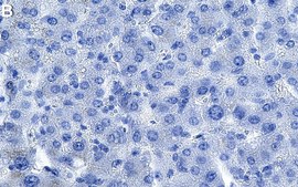 Anti-SLC13A5 Antibody, clone 1D4 ZooMAb&#174; Rabbit Monoclonal recombinant, expressed in HEK 293 cells
