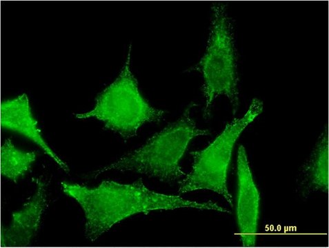 Monoclonal Anti-TBCC antibody produced in mouse clone 3D3, purified immunoglobulin, buffered aqueous solution