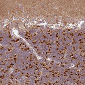 Anti-PRKAA2 antibody produced in rabbit Prestige Antibodies&#174; Powered by Atlas Antibodies, affinity isolated antibody, buffered aqueous glycerol solution
