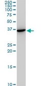 Monoclonal Anti-SNAI2 antibody produced in mouse clone 3C12, purified immunoglobulin, buffered aqueous solution