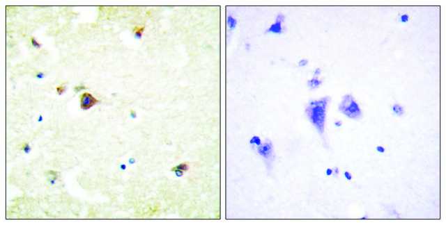 Anti-TRIM3 antibody produced in rabbit affinity isolated antibody