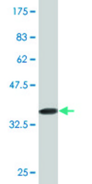 Monoclonal Anti-IL6R antibody produced in mouse clone 1E11, purified immunoglobulin, buffered aqueous solution