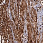 Anti-VCL antibody produced in rabbit Prestige Antibodies&#174; Powered by Atlas Antibodies, affinity isolated antibody, buffered aqueous glycerol solution