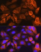 Anti-FABP1 antibody produced in rabbit