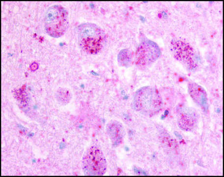 Anti-GPR21 (AB1) antibody produced in rabbit affinity isolated antibody, buffered aqueous solution