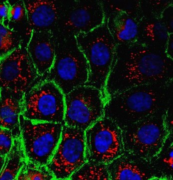 Anti-alpha-Actin Antibody, Smooth Muscle from rabbit, purified by affinity chromatography