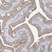 Anti-FNDC1 antibody produced in rabbit Prestige Antibodies&#174; Powered by Atlas Antibodies, affinity isolated antibody, buffered aqueous glycerol solution