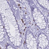 Anti-IL2RB antibody produced in rabbit Prestige Antibodies&#174; Powered by Atlas Antibodies, affinity isolated antibody, buffered aqueous glycerol solution