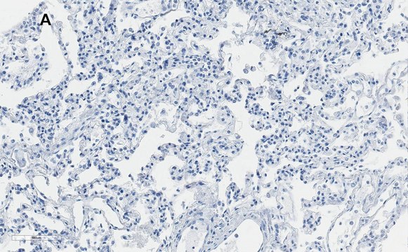 Anti-Integrin alpha V beta 6 Antibody, clone EM05201, ZooMAb&#174; Rabbit Monoclonal recombinant, expressed in HEK 293 cells