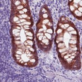 Monoclonal Anti-CA12 antibody produced in mouse Prestige Antibodies&#174; Powered by Atlas Antibodies, clone CL0280, purified immunoglobulin, buffered aqueous glycerol solution