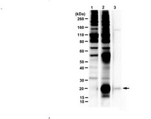 Anti-C9ORF72/C9RANT (Poly-GP sense/antisense) serum, from rabbit