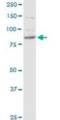 Monoclonal Anti-RRM1 antibody produced in mouse clone 1D6, purified immunoglobulin, buffered aqueous solution