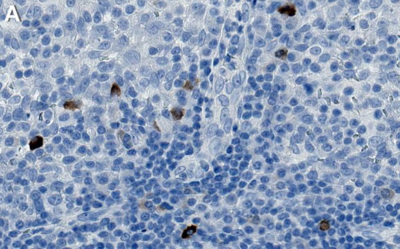 Anti-IL-10 Antibody, clone 1O10 ZooMAb&#174; Rabbit Monoclonal recombinant, expressed in HEK 293 cells