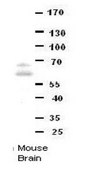Anti-DONSON antibody produced in rabbit affinity isolated antibody