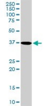 Anti-PDLIM1 antibody produced in rabbit purified immunoglobulin, buffered aqueous solution