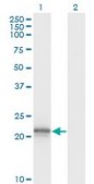 Monoclonal Anti-VHL antibody produced in mouse clone 1G12, purified immunoglobulin, buffered aqueous solution
