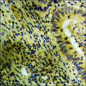 Anti-phospho-Catenin-&#946; (pTyr489) antibody produced in rabbit affinity isolated antibody