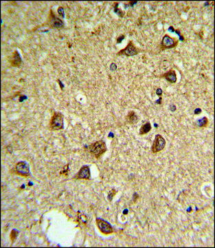 ANTI-DIO2 (CENTER) antibody produced in rabbit IgG fraction of antiserum, buffered aqueous solution