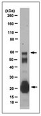 Anti-Cochlin Antibody/COCH, clone 9A10D2 clone 9A10D2, from rat